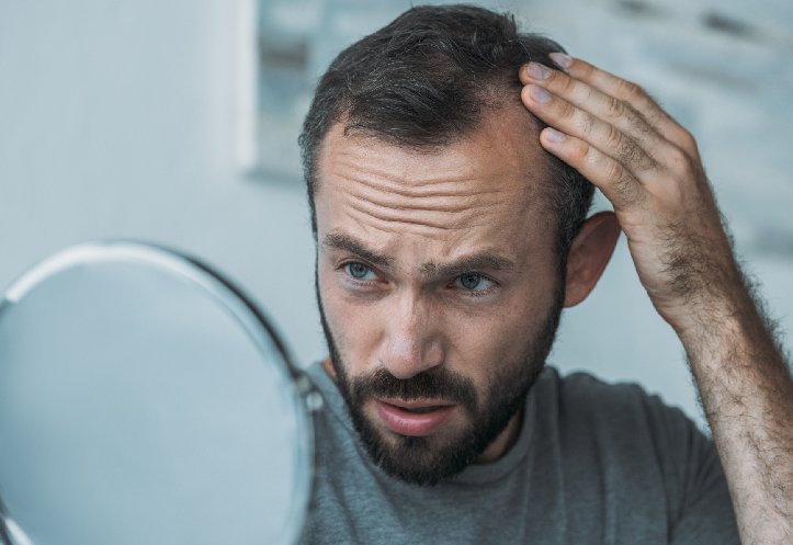 Considering Hair Transplant? Read this blog first!