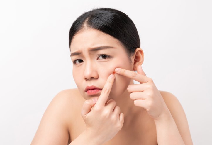 Types of Acne You Did Not Know About