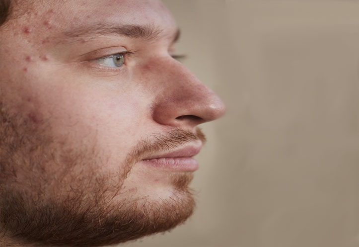 Advanced Skin Rejuvenating Treatments